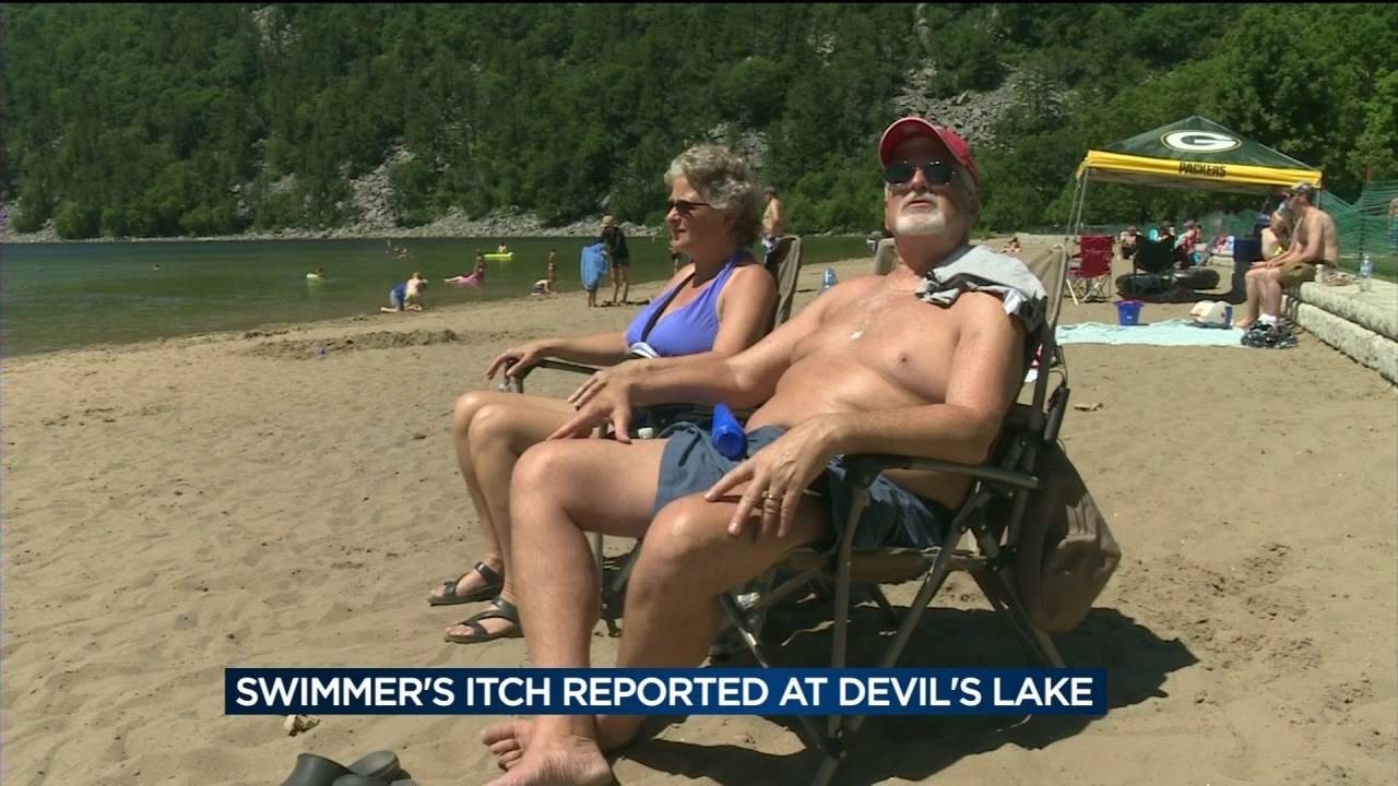 Swimmer&rsquo;s itch warning signs up at Devil&rsquo;s Lake State Park