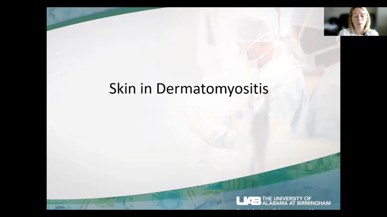 Миозит и кожа