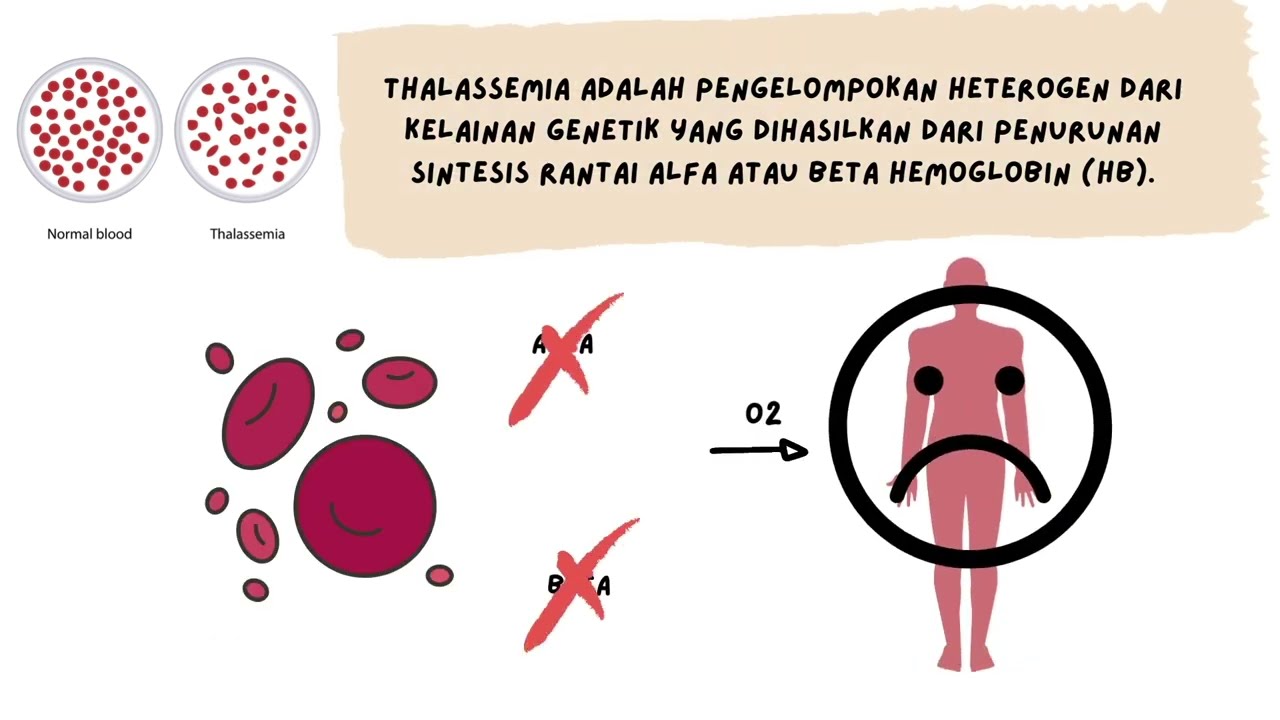 Autosomal resesif disease : Thalassemia