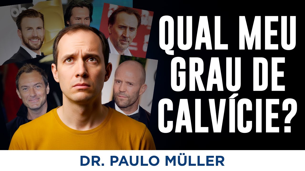 Qual o Seu Grau de Calvície? Aprenda com Exemplos Reais!