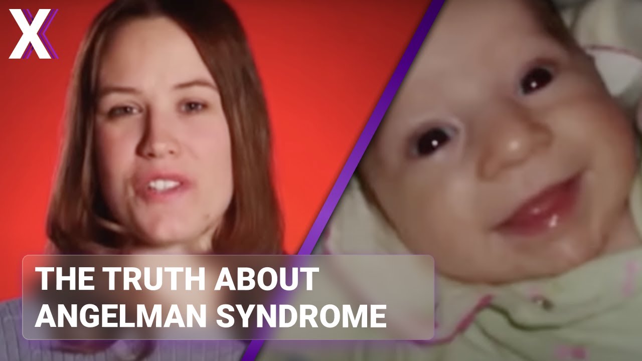 Angelman Syndrome and a Mother’s Fight