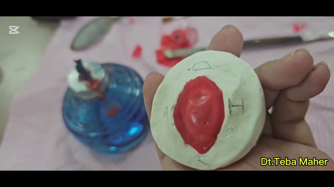 Waxing procedure of construction ocular prosthesis 