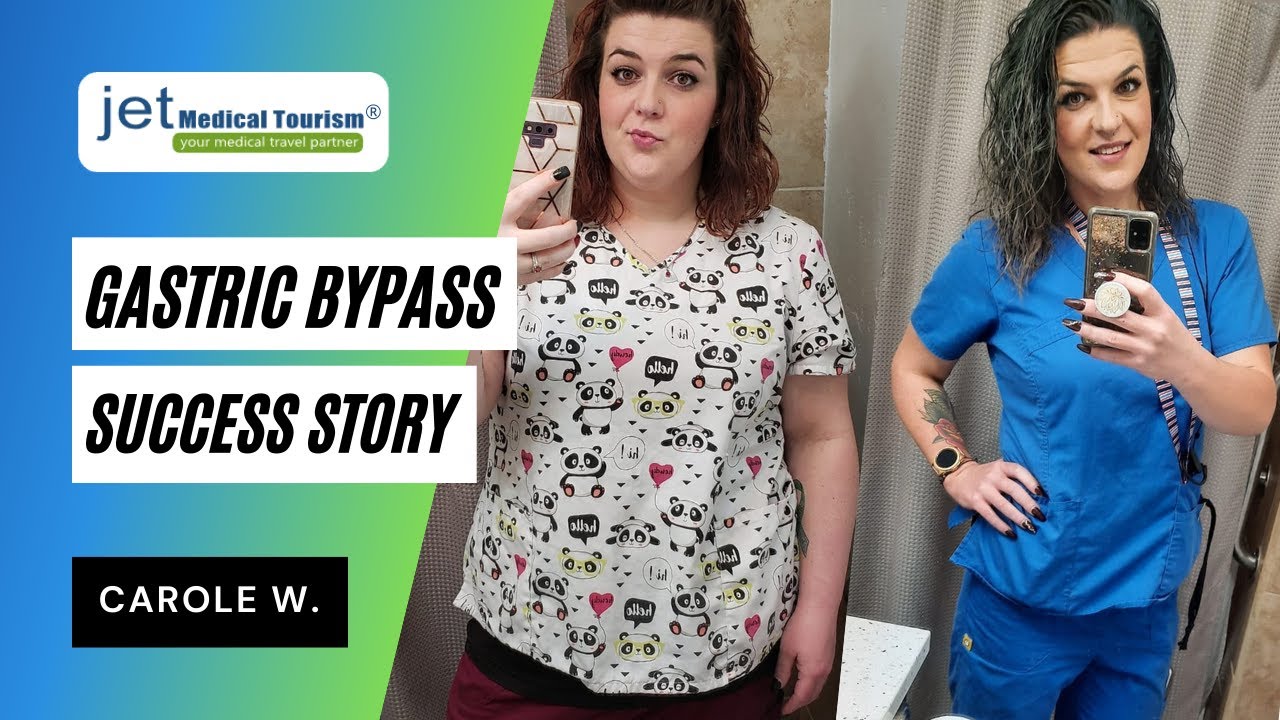 Gastric Bypass Success Story | RNY Surgery Before and After | Jet Medical Tourism®
