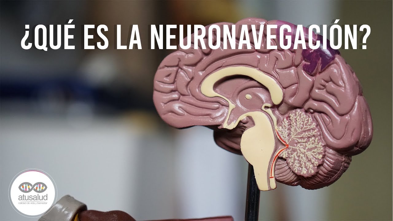 La Neuronavegaci&oacute;n Ayuda a Realizar Cirug&iacute;as Mediante Im&aacute;genes del Cerebro | Tecnolog&iacute;a sin L&iacute;mites