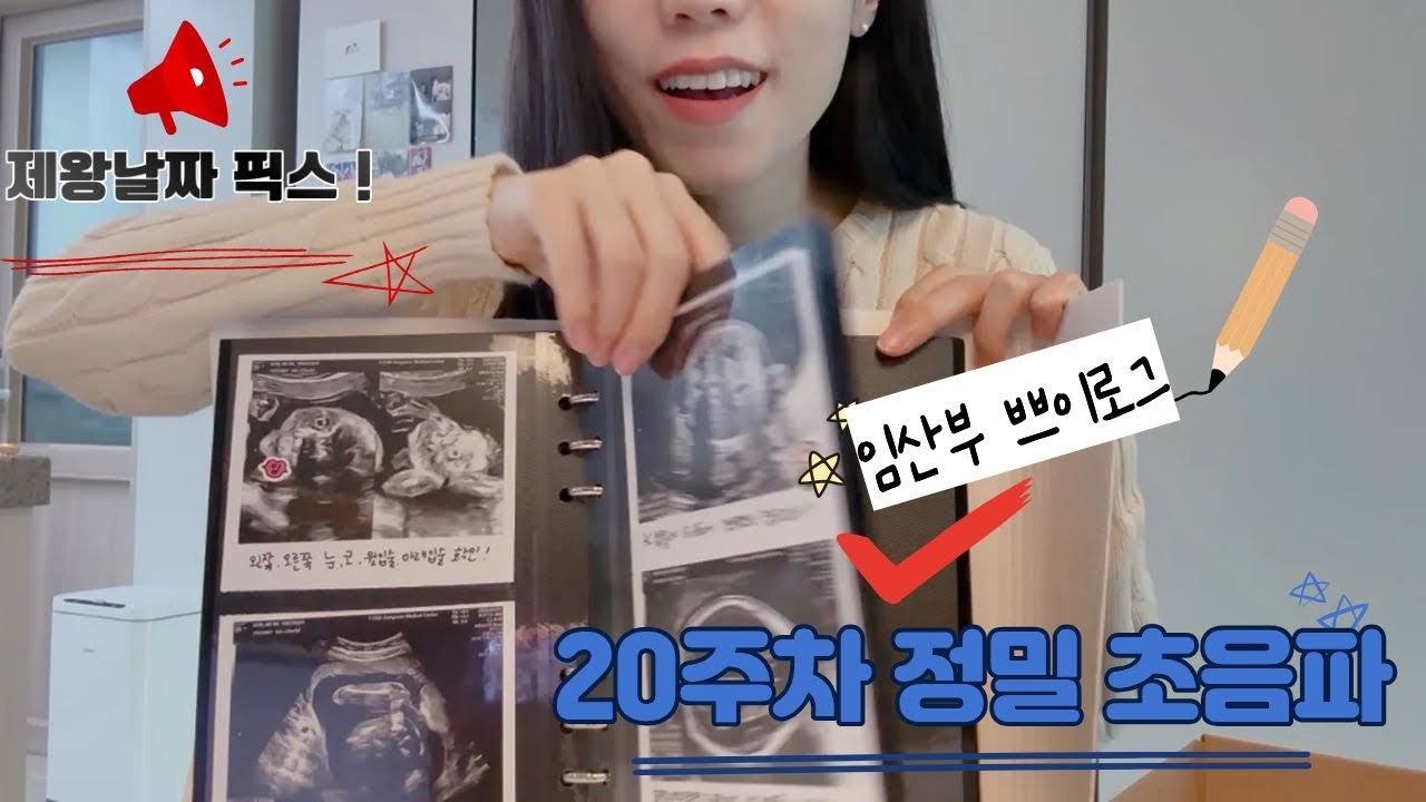 임산부vlog |  20주차 정밀 초음파📸 | 마티네차움강남 라운지☕️ | 제왕절개 날짜  | 체중 관리✔️