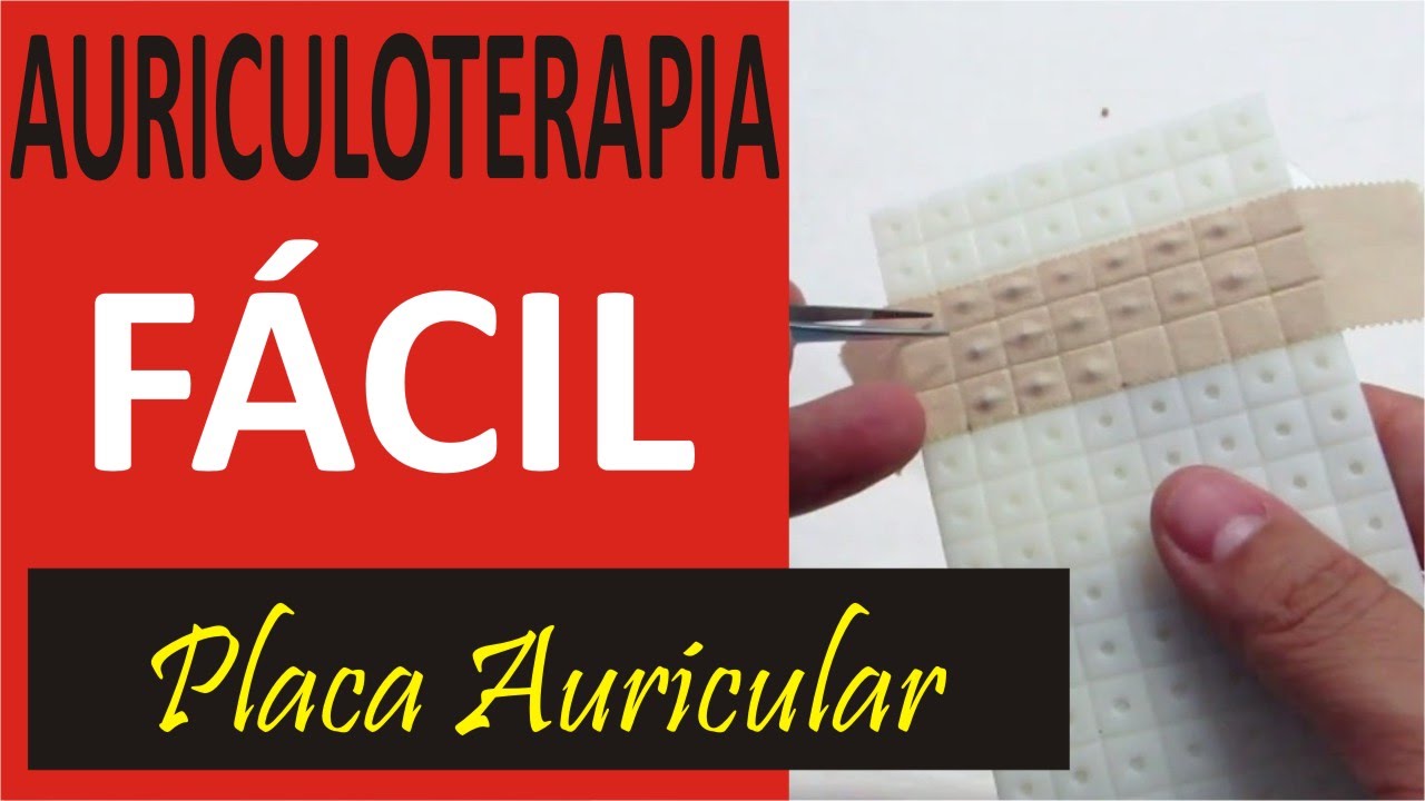 Aprenda a montar uma placa para Auriculoterapia