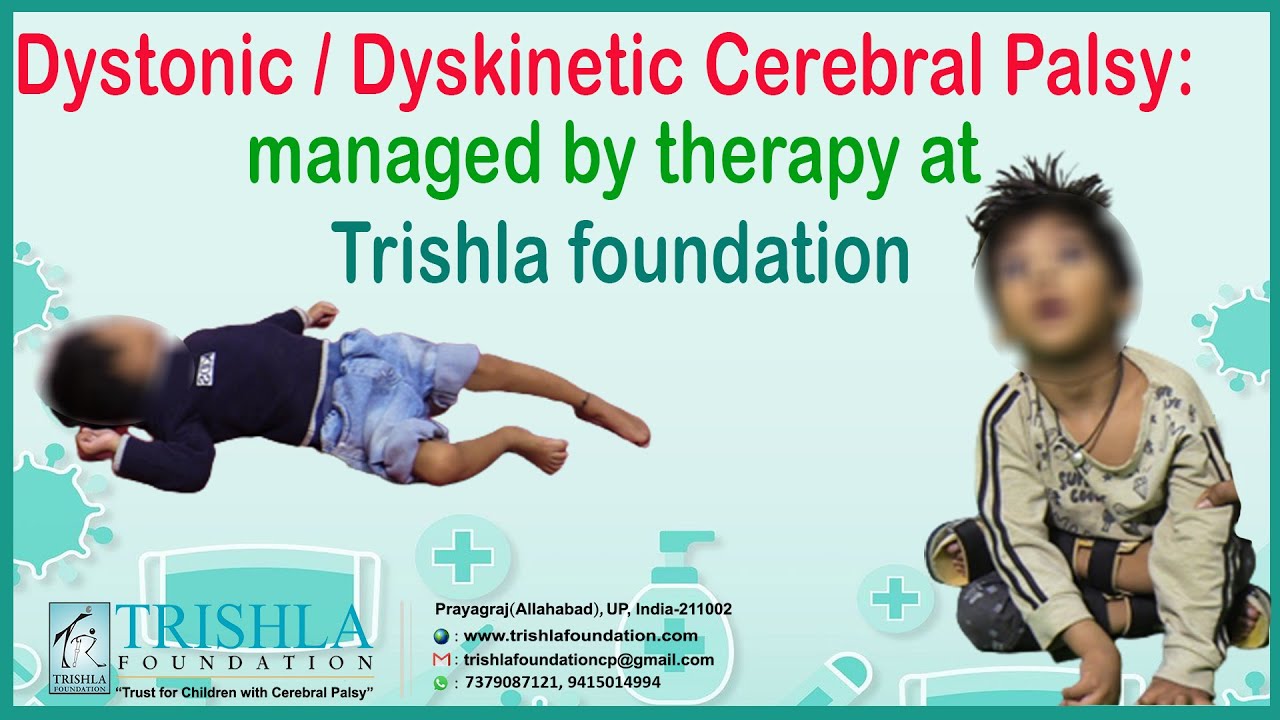 Dystonic / Dyskinetic Cerebral Palsy: managed by therapy at Trishla foundation