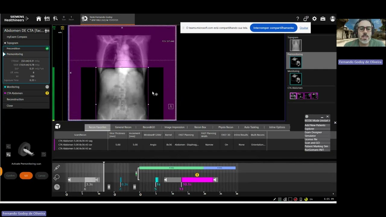 Realizando exame de angiotc da art&eacute;ria aorta abdominal e il&iacute;acas em Ap. Siemens (Somaton GoTop).