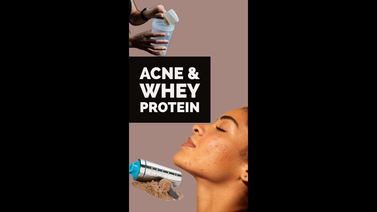 Acne and Whey Protein - What you need to know - - Dr Manisha Mareddy | Acne Treatment in Kokapet