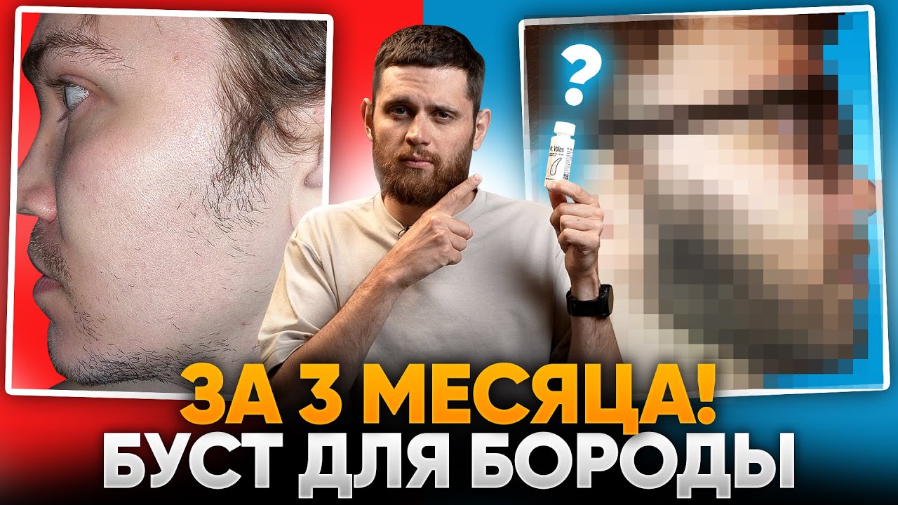 В 29 ЛЕТ НЕ РОСЛА БОРОДА / Результаты средства для роста бороды mr.Volos