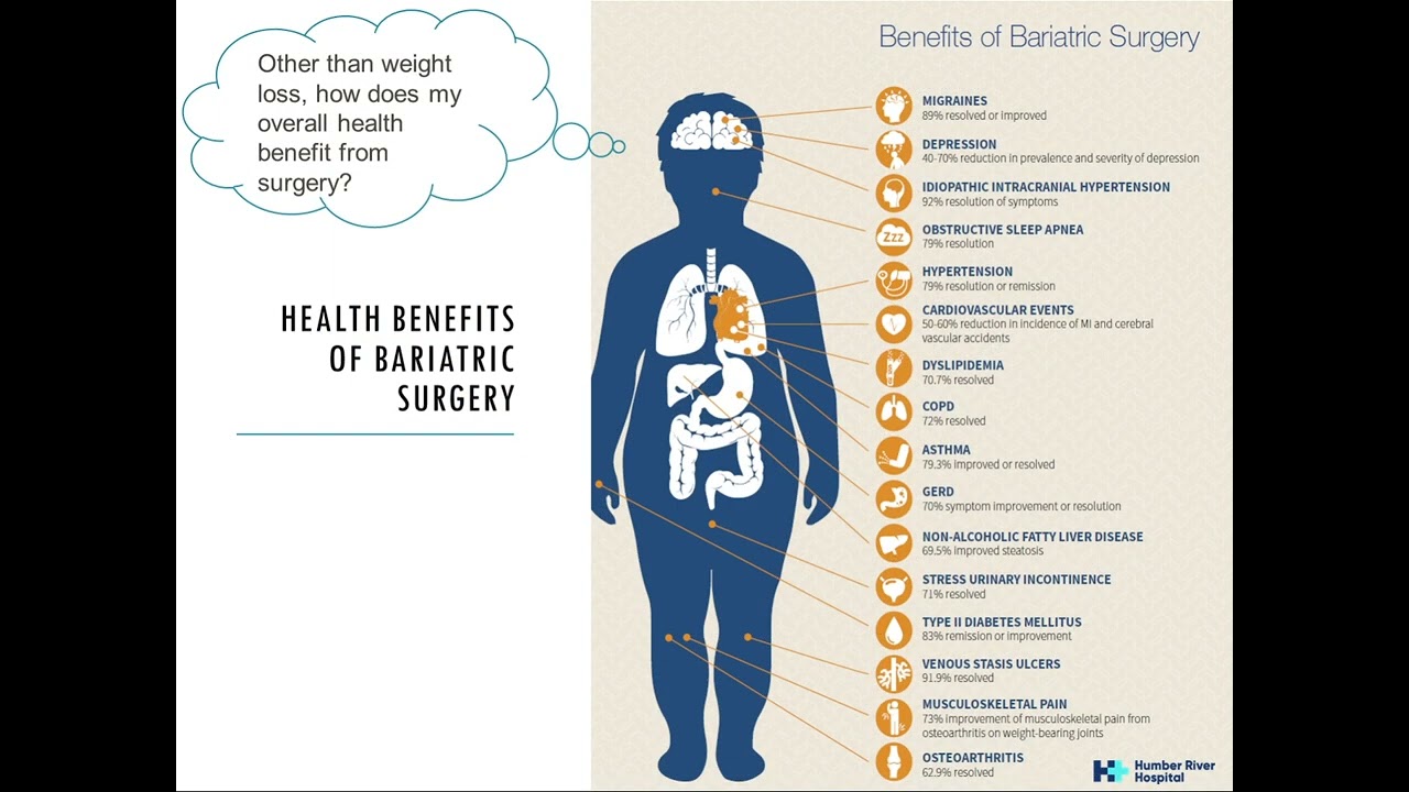 Bariatric Resource Videos - Part 2: Learning About Bariatric Surgery