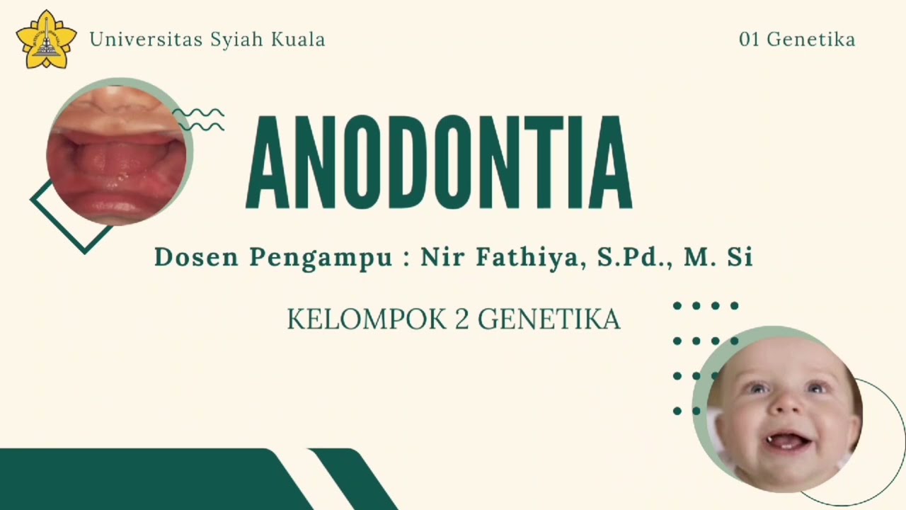PENYAKIT ANODONTIA