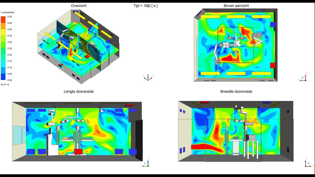 Air movement simulation Operating Room by ONE Simulations