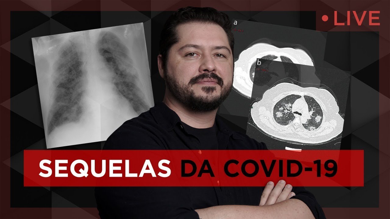 Live 02/10 - As sequelas da COVID