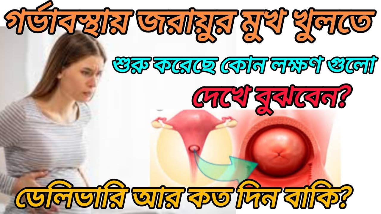 গর্ভাবস্থায় জরায়ুর মুখ খুলতে শুরু হয়েছে কি দেখে বুঝবেন। pregnancy cervix open | healthy pregnancy