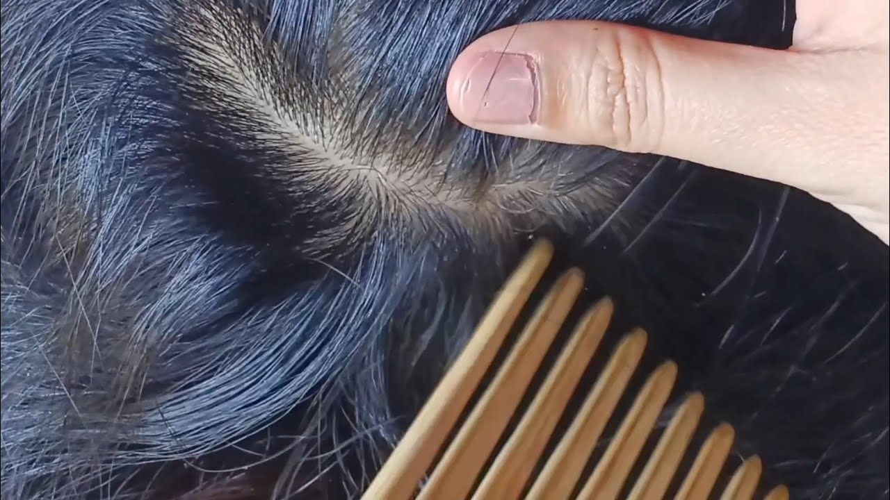 ASMR Hair Care: Scratching Dandruff With Comb