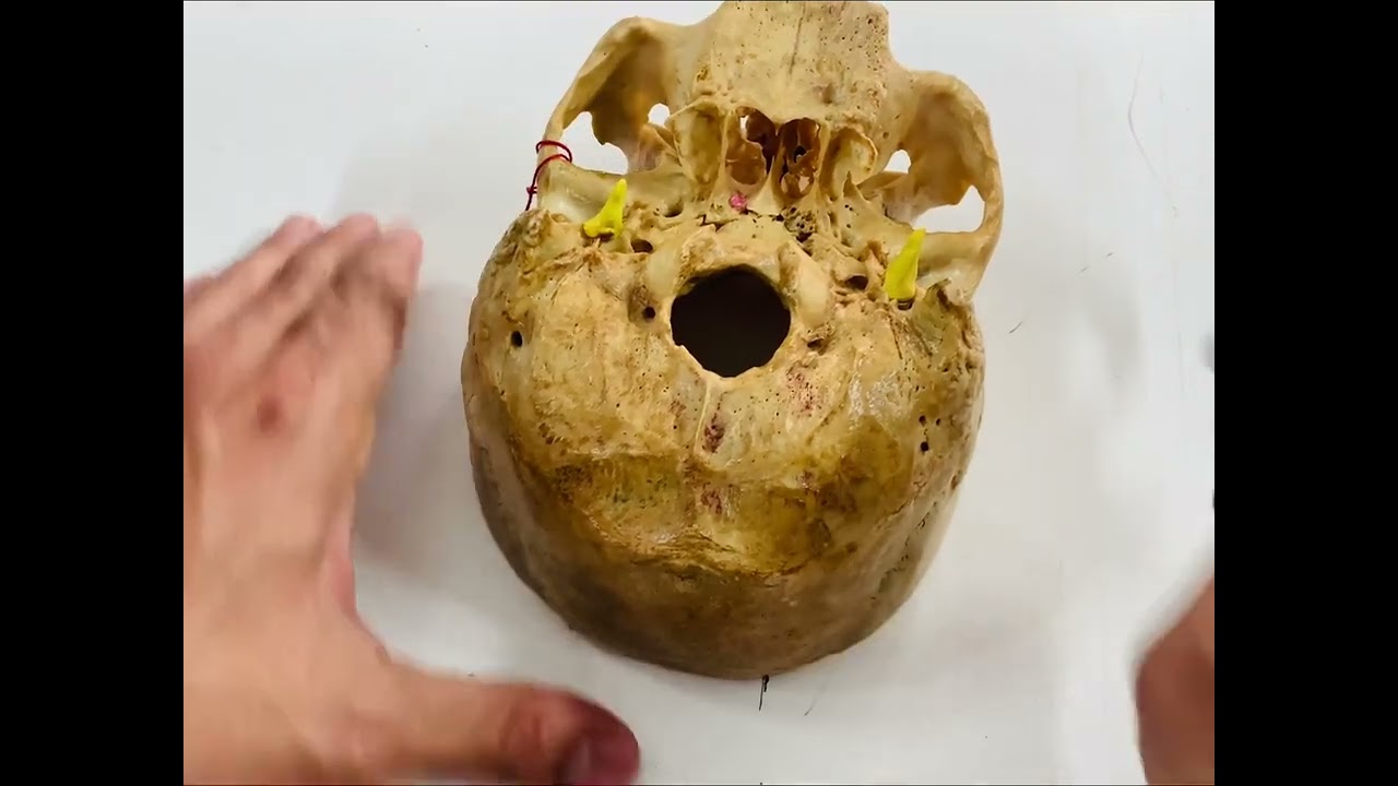 Exocráneo: Base. Dr. Diego Aldana