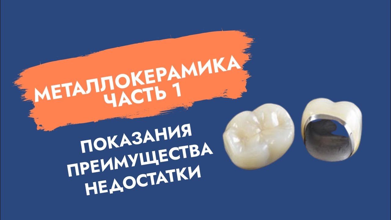 Металлокерамика (ч.1). Показания, преимущества, недостатки.