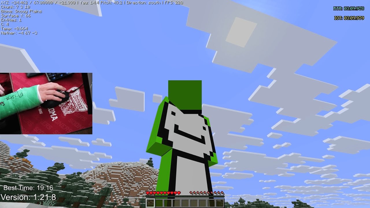 Speedrunning Minecraft With A Broken Arm