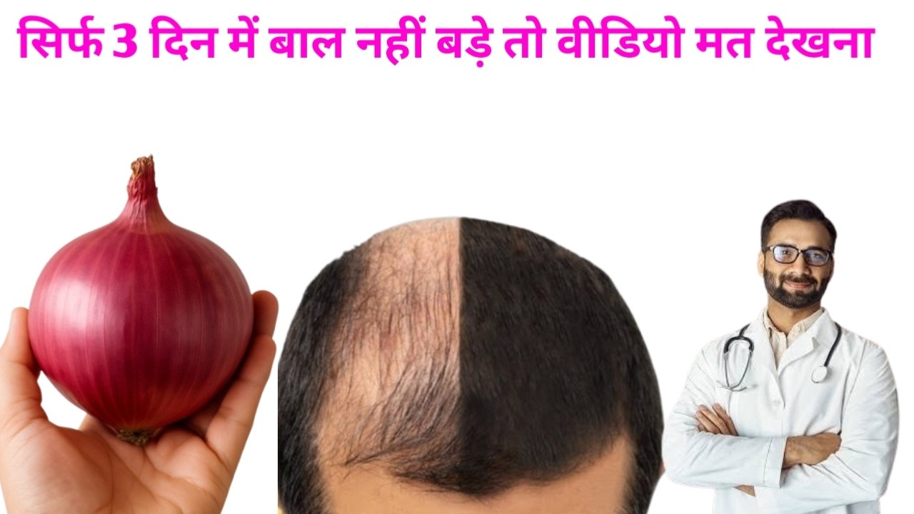 मैंने प्याज को इस डॉक्टर के बताए तरीके से लगाया,बाल बहुत ही तेजी से बढ़ने लगे,