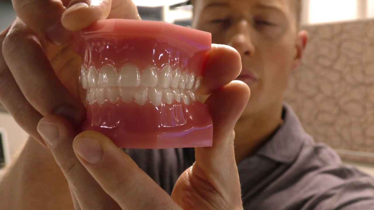 Can I Do Upper or Lower Only With Invisalign? • Invisalign FAQ
