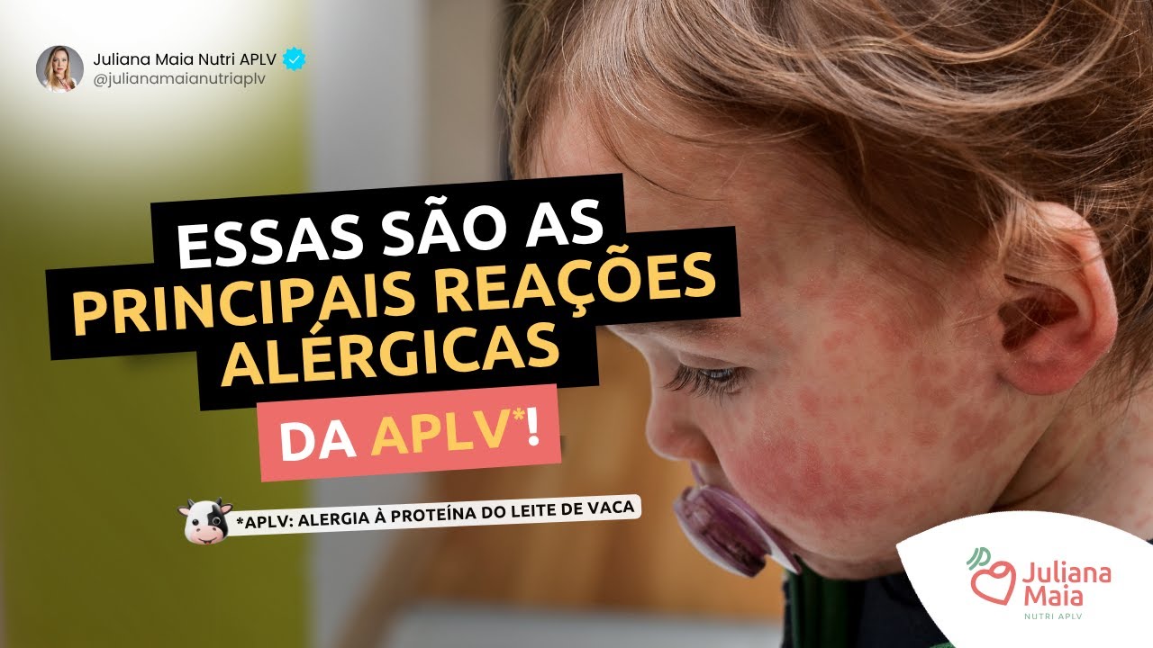 Essas são as principais reações alérgicas da APLV!