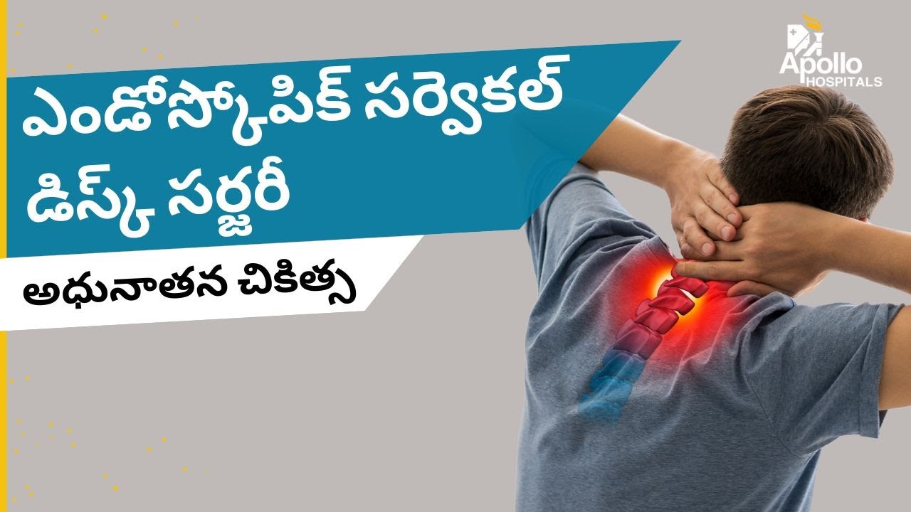 ఎండోస్కోపిక్ సర్వెకల్ డిస్క్ సర్జరీ యొక్కి అధునాతన చికిత్స Advanced Endoscopic Cervical Disc Surgery