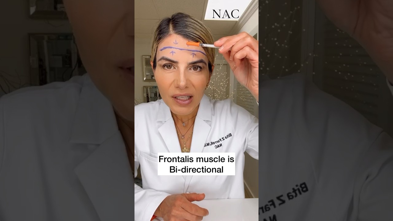Forehead Botox #botox #drbitafarrell #beauty