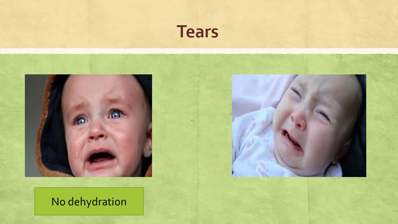 Sheet of Acute Diarrhea