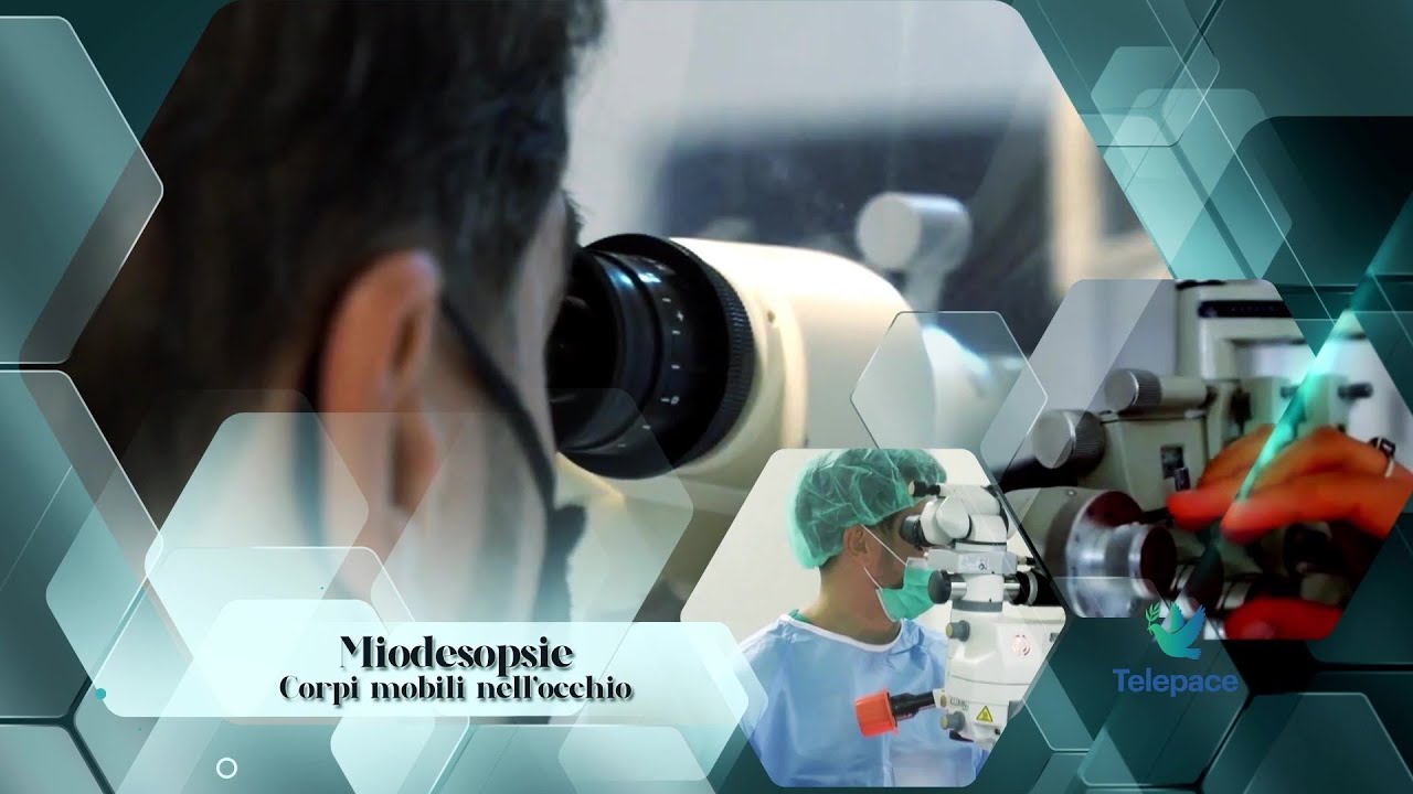 Il medico risponde - Tx 08 Miodesopsie, corpi mobili nell'occhio