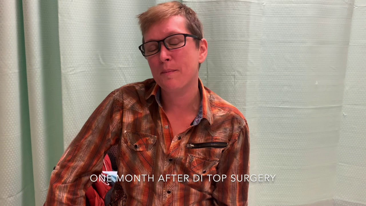 Temporary swelling/ seroma after FTM double incision top surgery with Dr Mckee