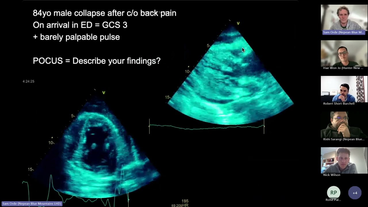 Critical care echo cases