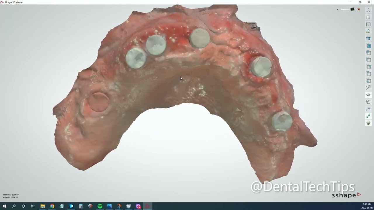 DentalTechTutorial - How to use 3shape's Implant Waxup Bridge Workflow For Converting Your Waxup