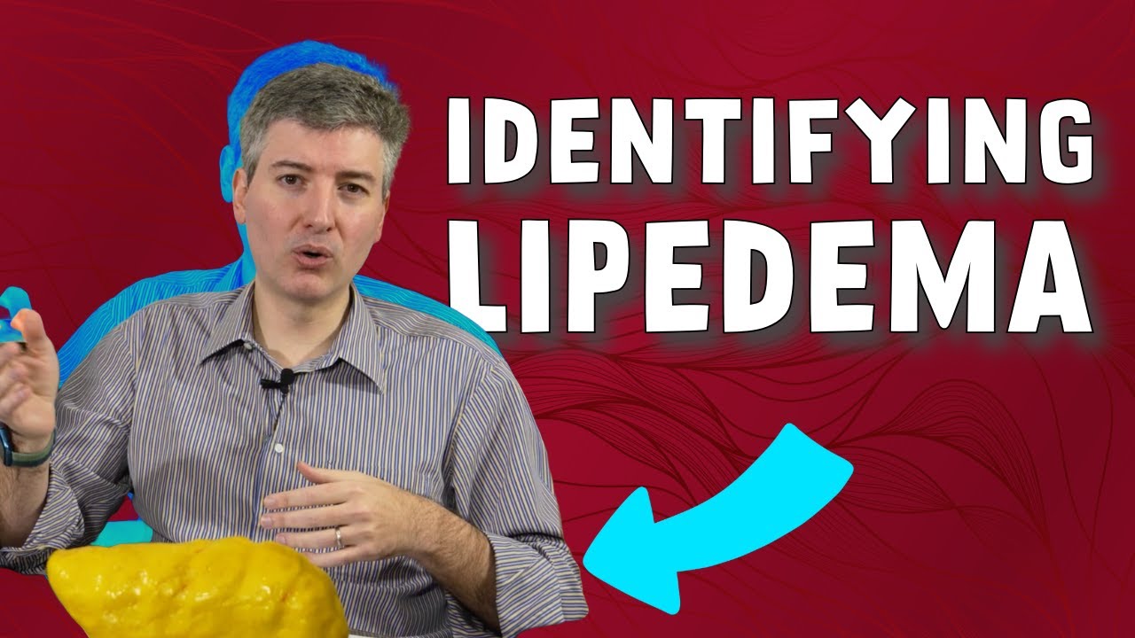 How is Lipedema Identified?