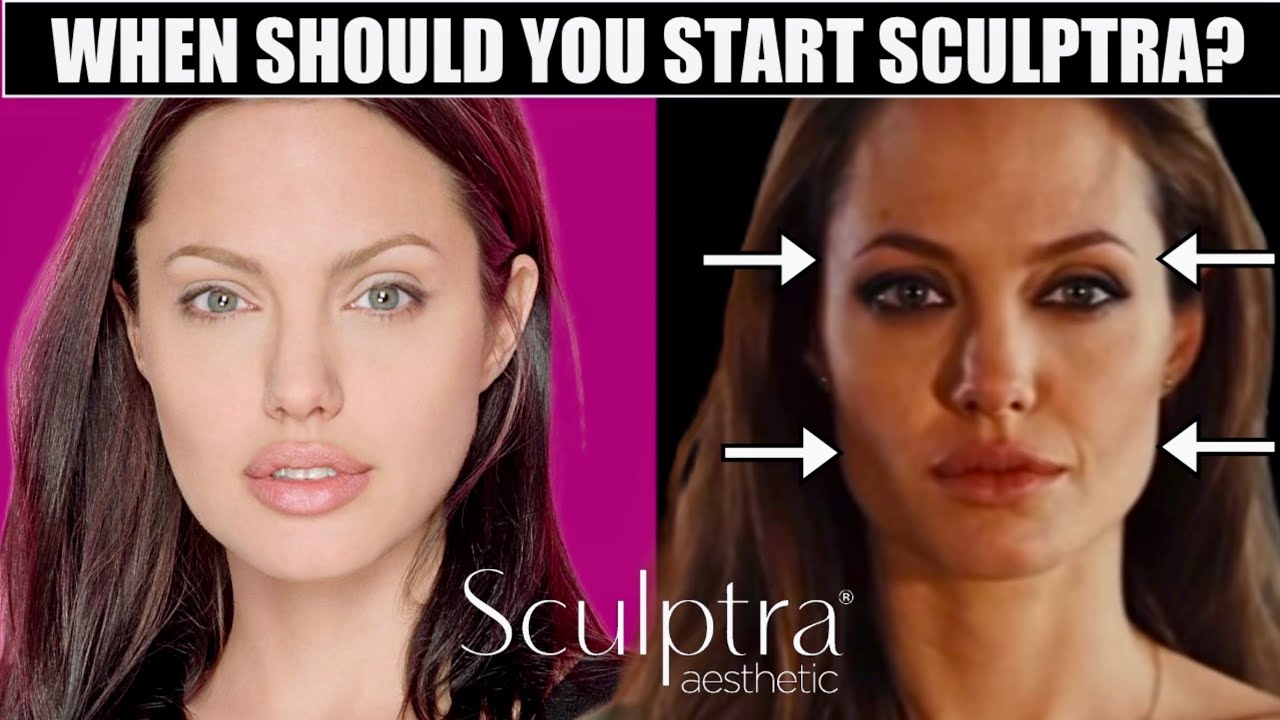 Когда начинать Sculptra? Признаки, по которым стоит начать прямо сейчас