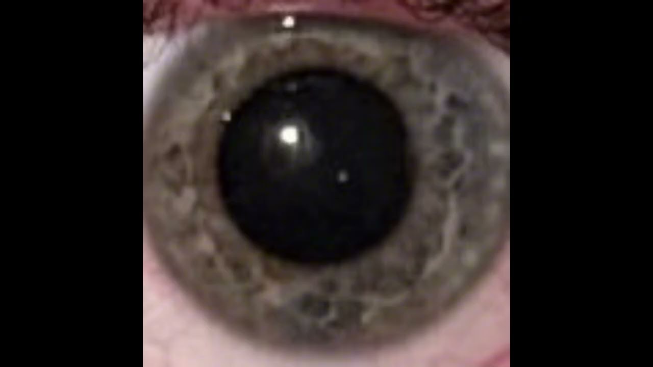 My Eye [Full Album]