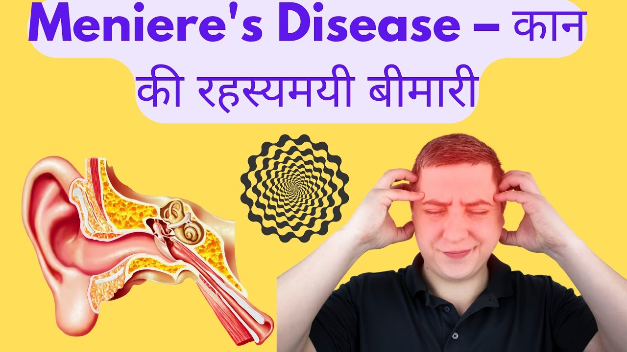 "Meniere's Disease क्या है? | मिनिएर्स रोग के लक्षण, कारण और इलाज | हिंदी में जानें"