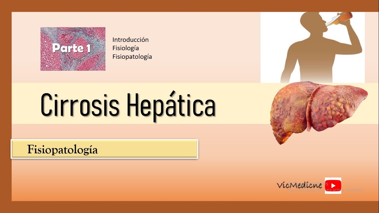 CIRROSIS HEPATICA PARTE 1 FISIOPATOLOGIA