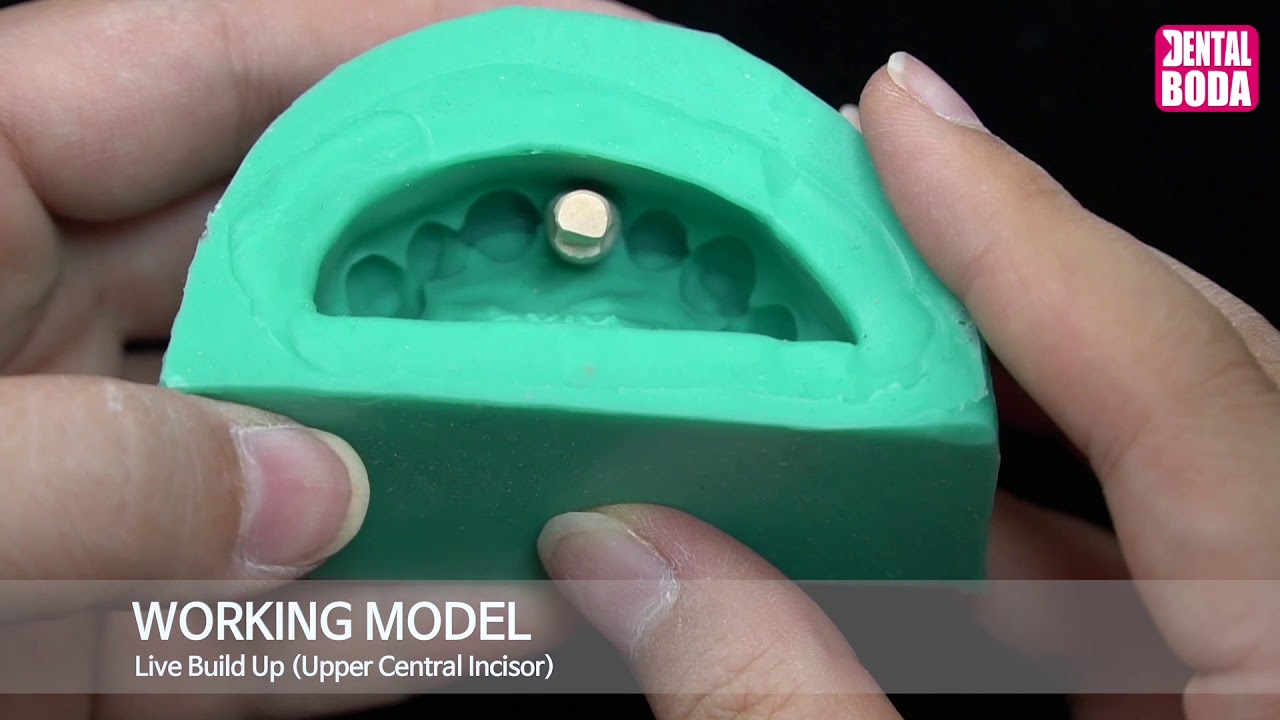 Working model