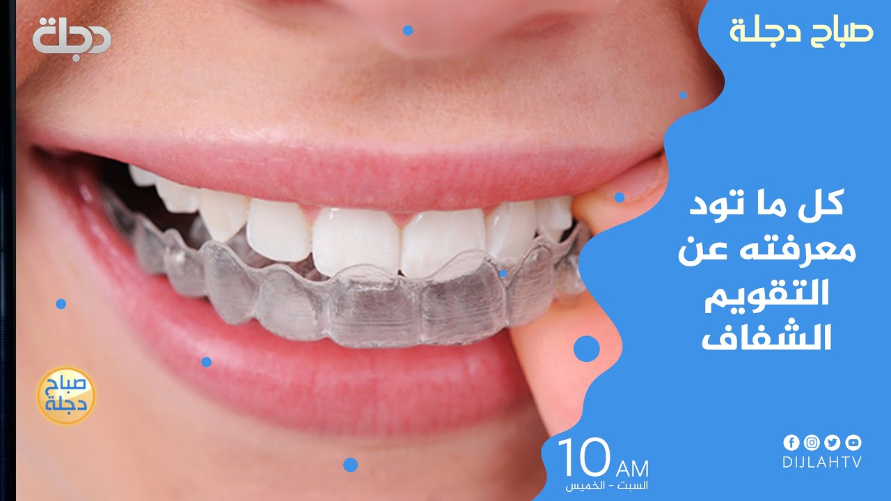 مميزات وعيوب التقويم الشفاف للأسنان مع الدكتور مصطفى غني