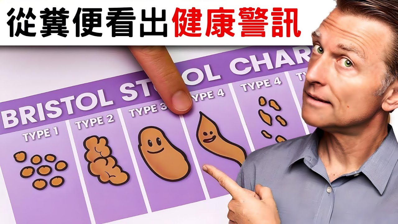 從糞便看出健康問題,自然療法,柏格醫生 Dr Berg