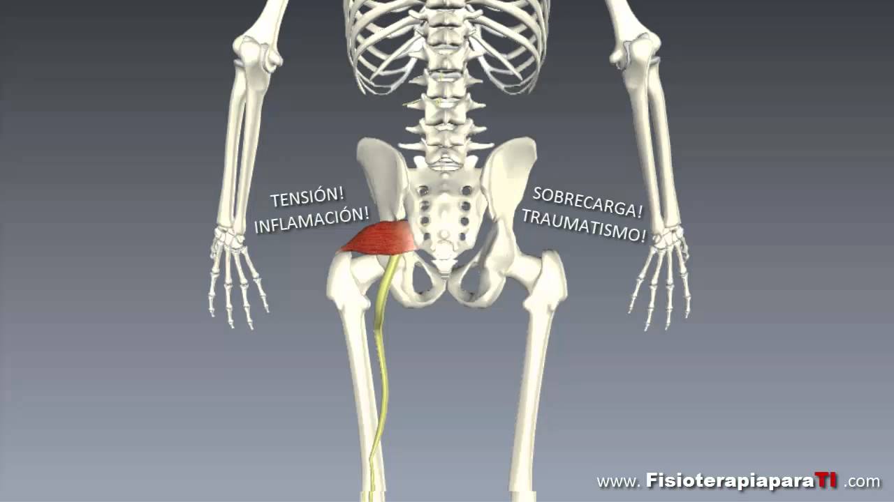 Test de Lasegue. Cómo valorar la irritación del nervio ciático - Fisioterapia para TI