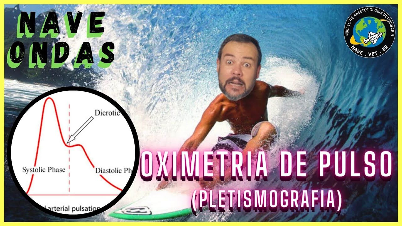 🔴  INTERPRETANDO A OXIMETRIA (PLETISMOGRAFIA) | NAVE Ondas #2