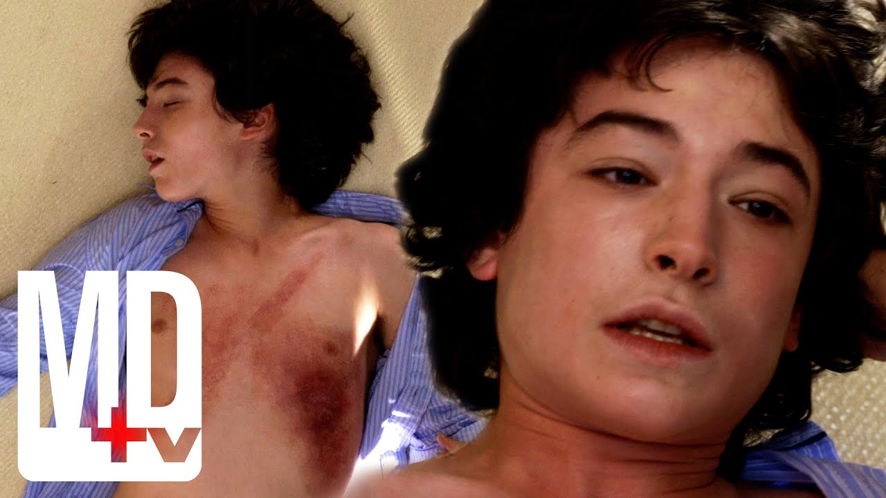Will a Young Hemophiliac Stop Bleeding? (Ezra Miller) | Royal Pains | MD TV