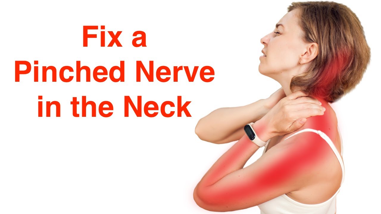 Fix a Pinched Nerve in the Neck (With FREE Exercise Sheet!)