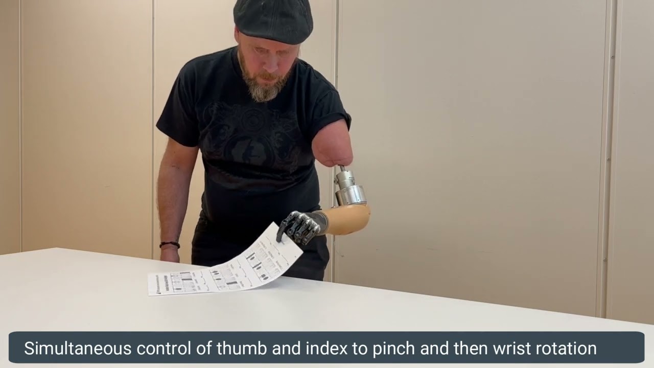 Intuitive simultaneous and proportional control of a bionic hand