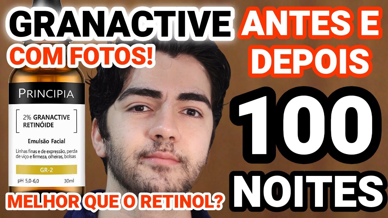 100 NOITES DE USO GRANACTIVE RETINÓIDE PRINCIPIA! MELHOR QUE RETINOL? COM FOTOS ANTES E DEPOIS GR-2!