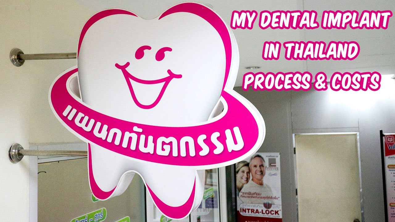 How Much Did I Pay For A Dental Implant In Thailand?