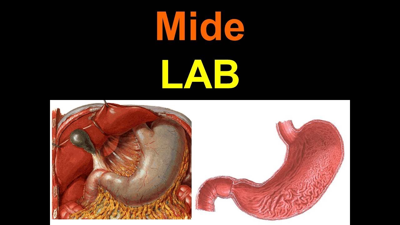 Mide LAB