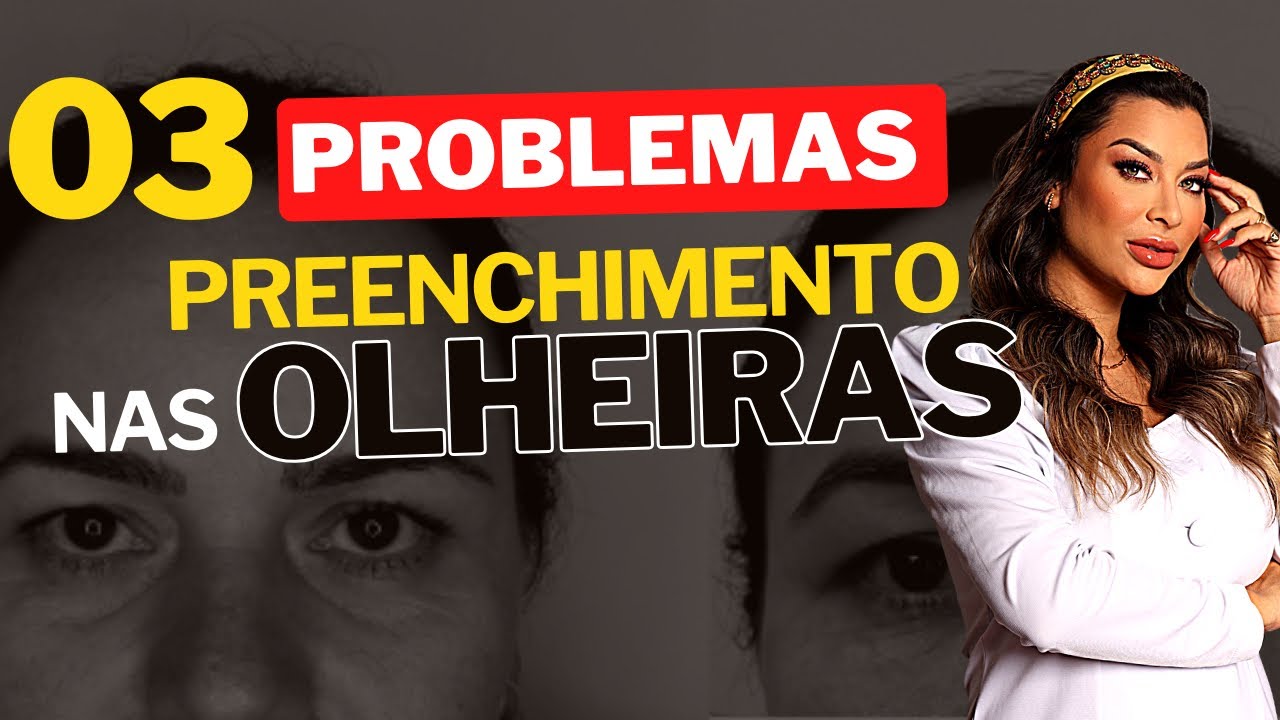 03 problemas - preenchimento em olheiras com ácido hialurônico